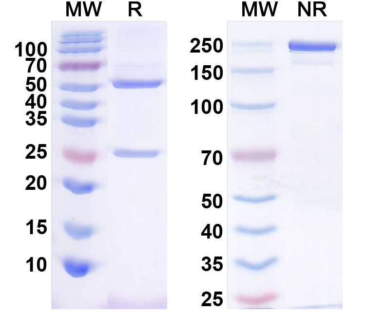 SDS-PAGE for Anti-Fig4/Sac3 Antibody (N202/38)