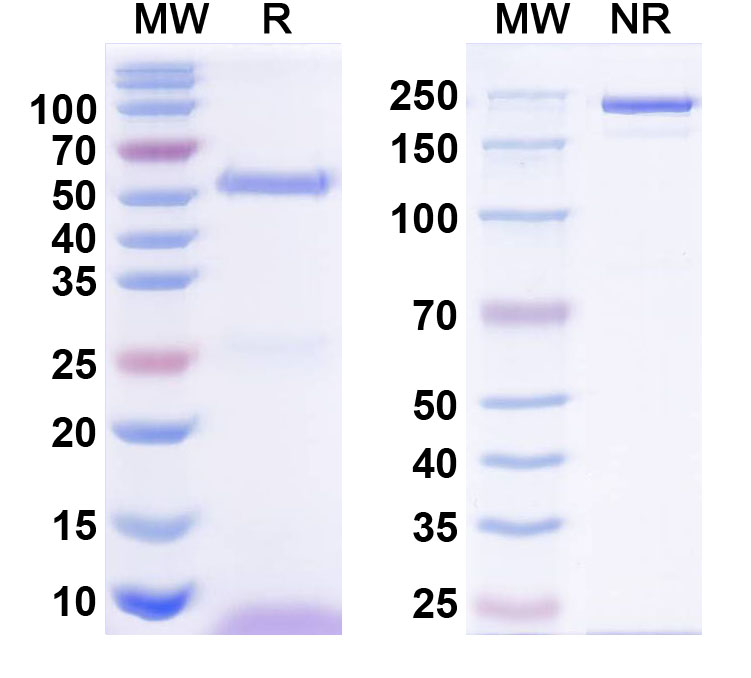 SDS-PAGE for Anti-GABA(A)R, Beta1 Antibody (N96/53)