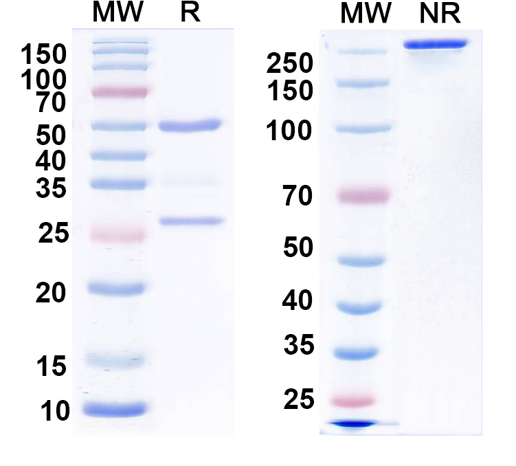 SDS-PAGE for Anti-GABA(A)R, Beta2/3 Antibody (62-3G1)