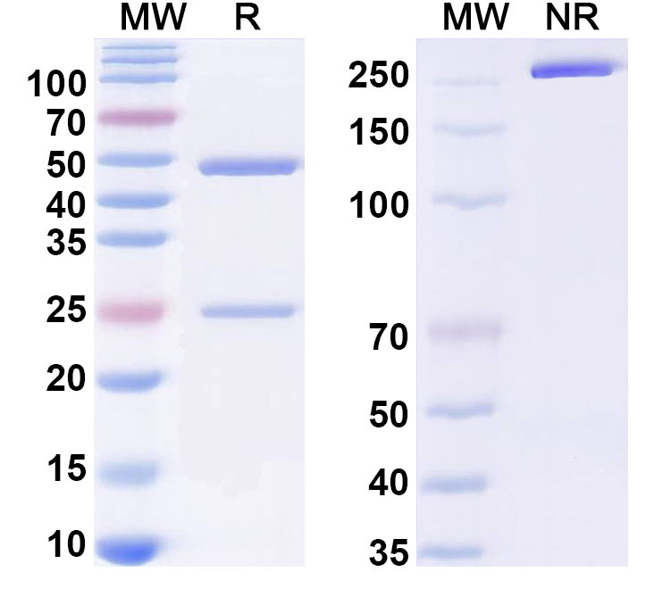 SDS-PAGE for Anti-Ganglioside GM1 Antibody  (F6)