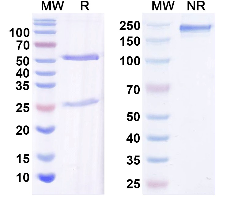 SDS-PAGE for Anti-GluN2C/NR2C glutamate receptor Antibody (N422/18)