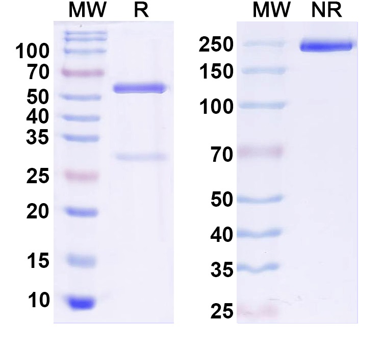 SDS-PAGE for Anti-GluN3A/NR3A glutamate receptor Antibody (K35/40)