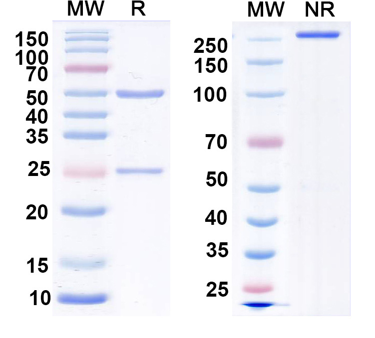 SDS-PAGE for Anti-GRK6A/B Antibody (N142/17)