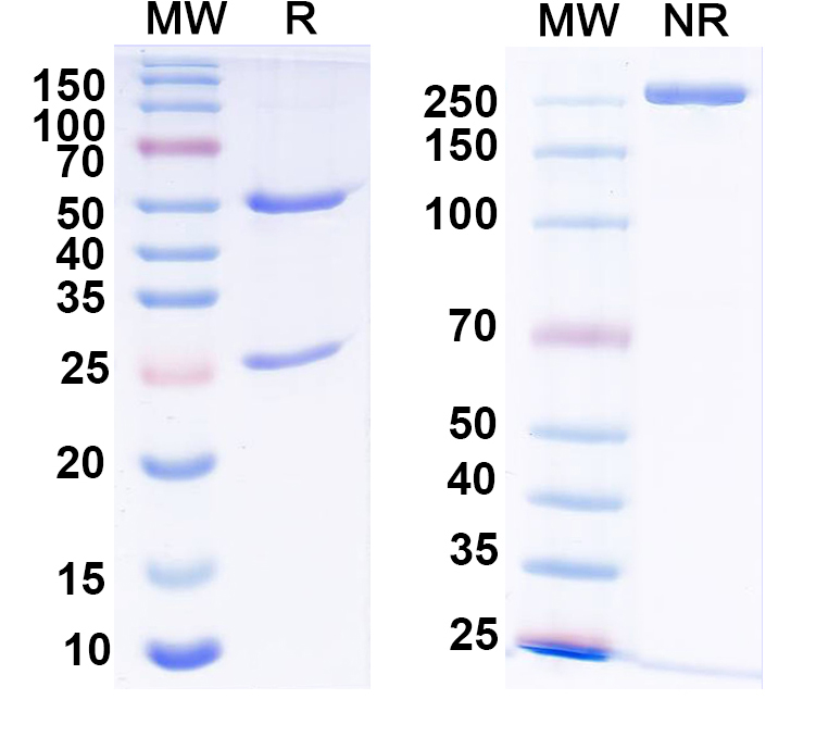 SDS-PAGE for Anti-Gs protein, alpha subunit Antibody (N192/12)