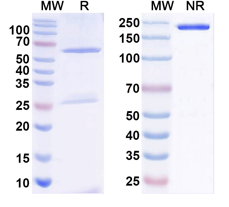 SDS-PAGE for Anti-Haemophilus influenzae ompP1 Antibody (SAA1426)