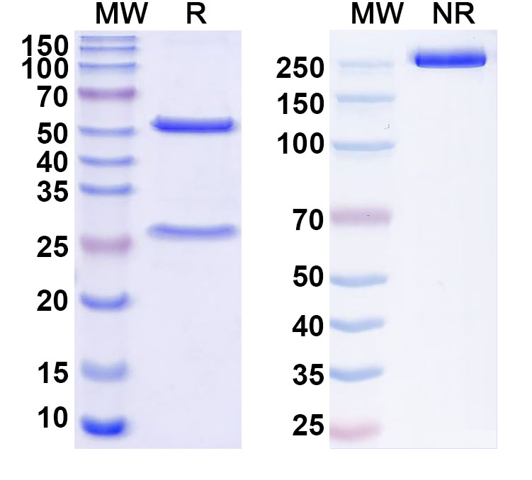 SDS-PAGE for Anti-HBV preS2 domain Antibody (F124)