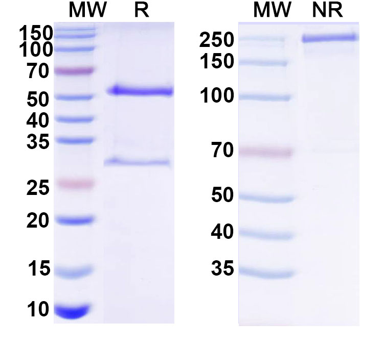 SDS-PAGE for Anti-HCV Genome polyprotein Antibody (D32.10)