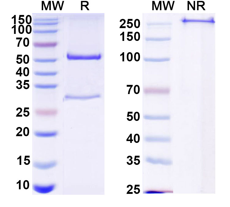 SDS-PAGE for Anti-HCV Hepacivirin/NS3 helicase/NS3P/Viroporin p70 Antibody (41#)
