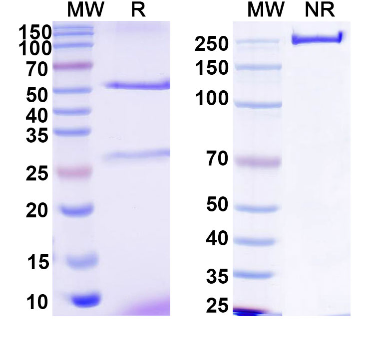 SDS-PAGE for Anti-HCV NS1/gp68/gp70/Envelope glycoprotein E2 Antibody (1:11#)