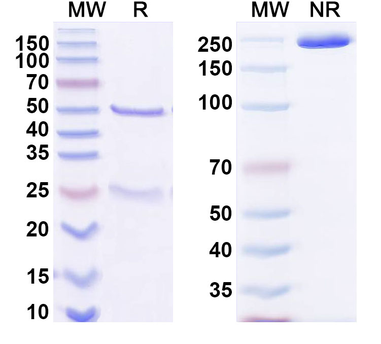 SDS-PAGE for Anti-HCV NS1/gp68/gp70/Envelope glycoprotein E2 Antibody (22D11)