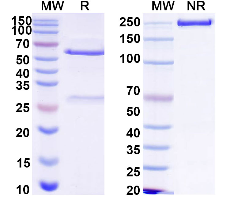 SDS-PAGE for Anti-HCV NS1/gp68/gp70/Envelope glycoprotein E2 Antibody (L1)