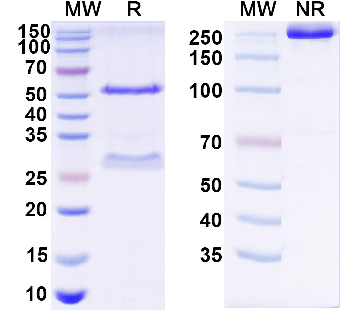 SDS-PAGE for Anti-HCV NS1/gp68/gp70/Envelope glycoprotein E2 Antibody (mAb#12)