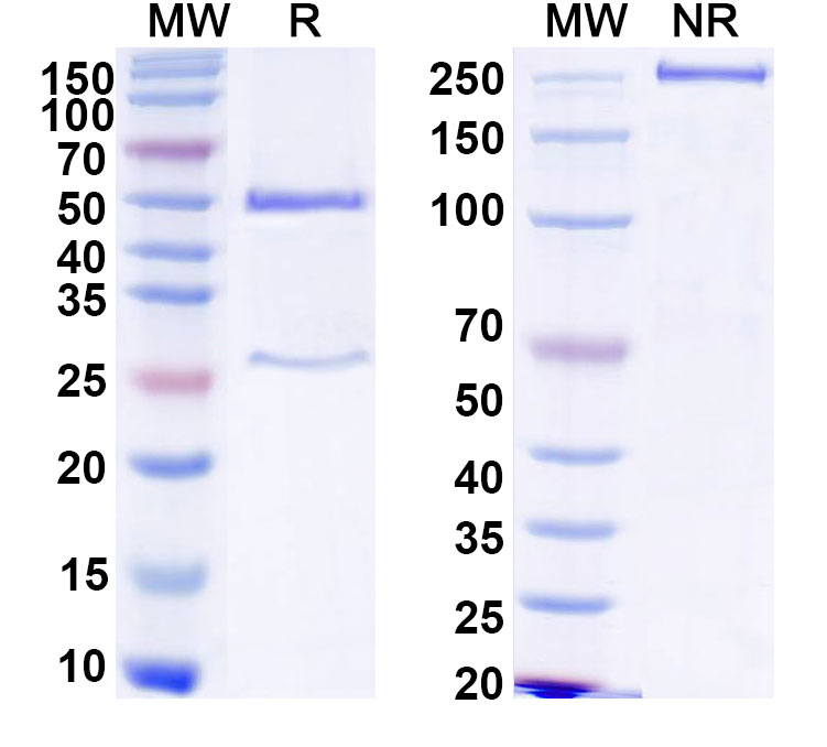 SDS-PAGE for HCV NS1/gp68/gp70/Envelope glycoprotein E2 Monoclonal Antibody AR3C