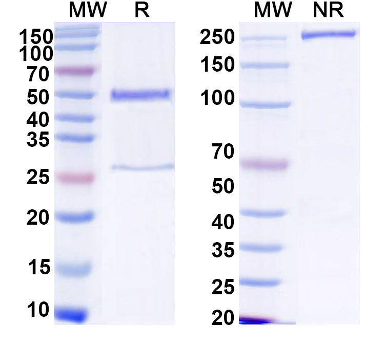 SDS-PAGE for Anti-HCV NS1/gp68/gp70/Envelope glycoprotein E2 Monoclonal Antibody, D03