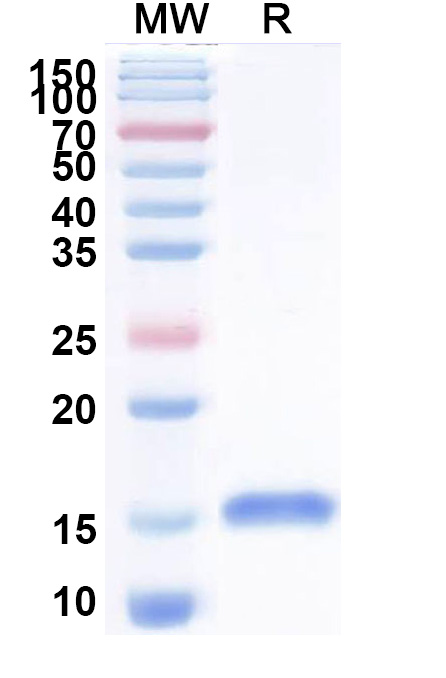 SDS-PAGE for Anti-Helicobacter pylori babA VHH (Nb-ER19)