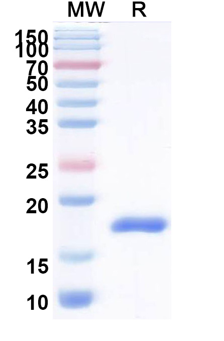 SDS-PAGE for Anti-Helicobacter pylori babA2 VHH (Nb-ER14)