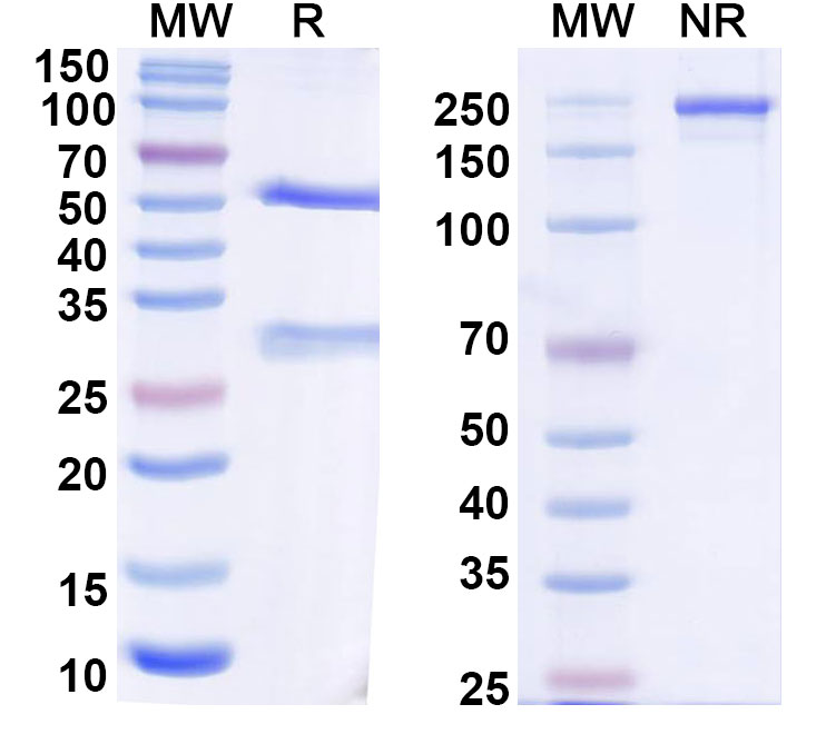 SDS-PAGE for Anti-Helicobacter pylori HP_1019/Periplasmic serine endoprotease DegP-like Monoclonal Antibody (1A176)