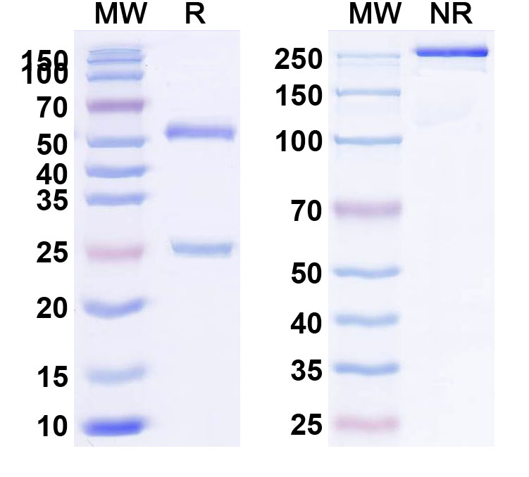 SDS-PAGE for Anti-HHV-5/HCMV gB/Envelope glycoprotein B Antibody (1B03)