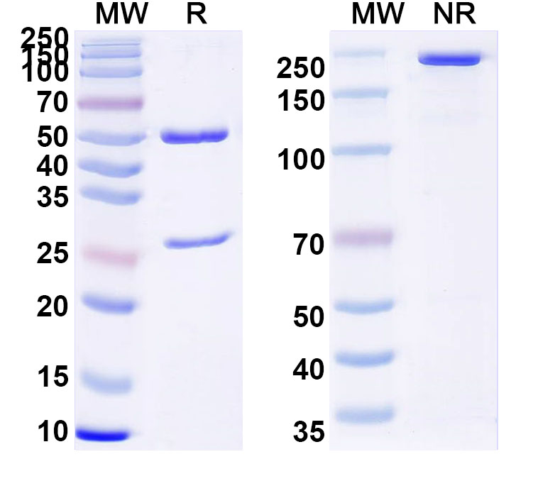 SDS-PAGE for Anti-HIV-1 Matrix protein p17/MA protein Antibody (M33)