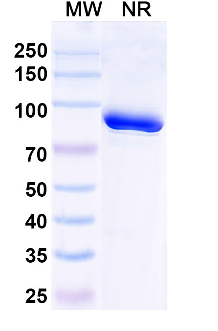 SDS-PAGE for Anti-HPV16 E6/Protein E6 Antibody (Nb9)
