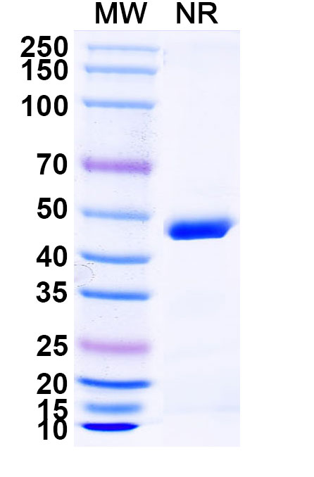 SDS-PAGE for Anti-HPV16 E6/Protein E6 Antibody (SAA2275)