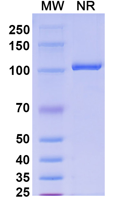 SDS-PAGE for Anti-HPV16 E6/Protein E6 Antibody (SAA2276)