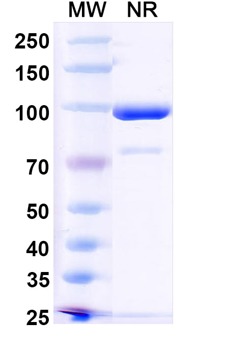 SDS-PAGE for Anti-HPV16 E7/Protein E7 Antibody (Nb27)