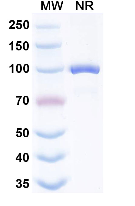 SDS-PAGE for Anti-HPV16 E7/Protein E7 Antibody (Nb4)