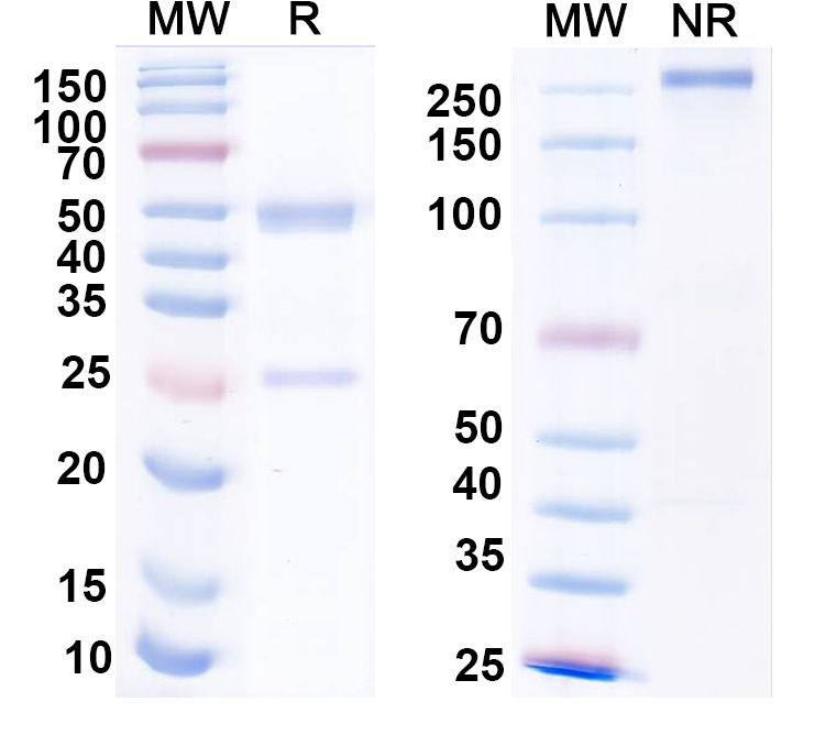 SDS-PAGE for Anti-HPV16 L1/Major capsid protein L1 Antibody (H263.A2)