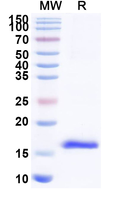 SDS-PAGE for Anti-HRSV F/Fusion glycoprotein F0 VHH (SAA0982)