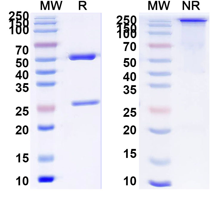 SDS-PAGE for Anti-Human ABL1/p150 Antibody (SAA0785)