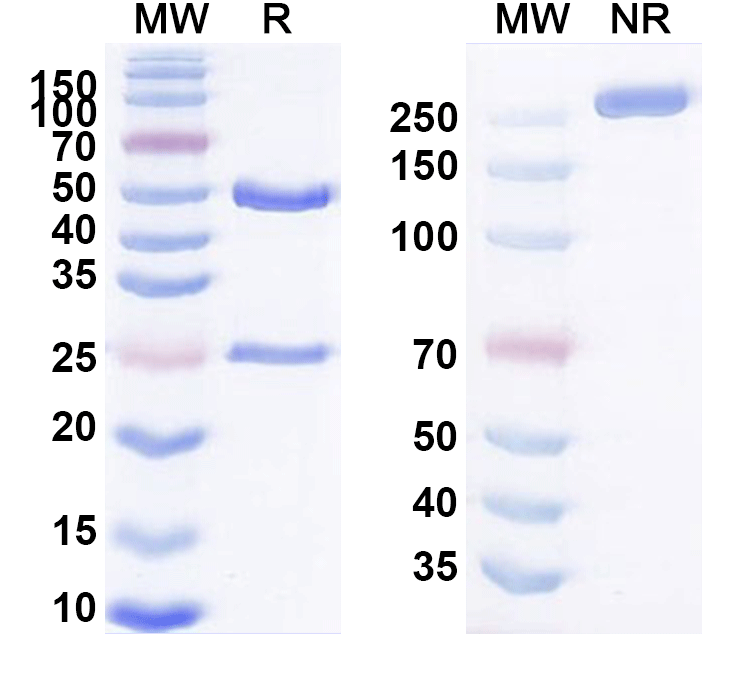 SDS-PAGE for Anti-Human ACTH (ALD1613)