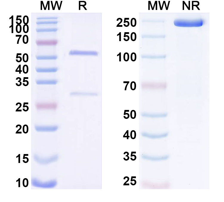 SDS-PAGE for Anti-Human ADAM28 Monoclonal Antibody (ABS1331)