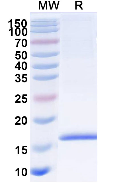 SDS-PAGE for Anti-Human Adiponectin/ACRP30/ADIPOQ VHH (SAA1153)