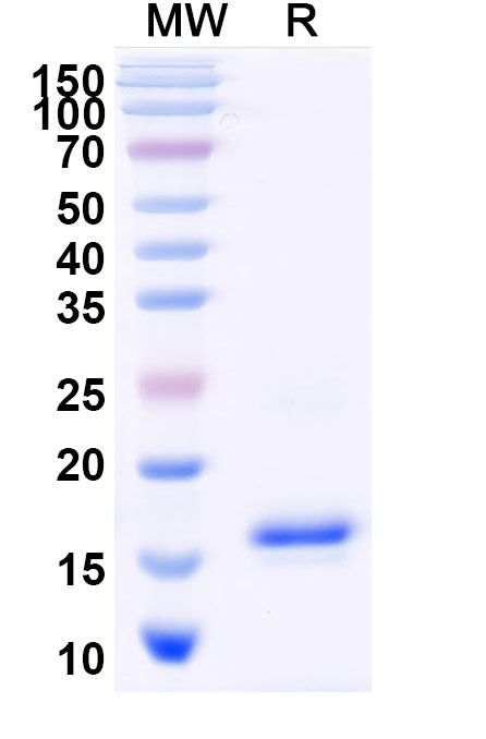 SDS-PAGE for Anti-Human ADRB2 VHH (SAA1156)