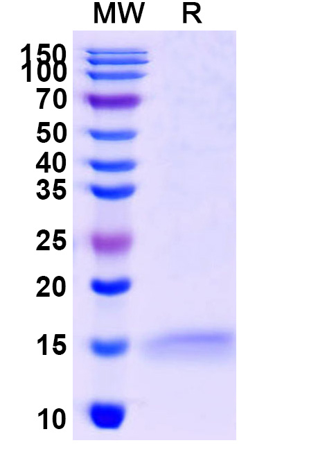 SDS-PAGE for Anti-Human ADRB2 VHH (SAA1252)