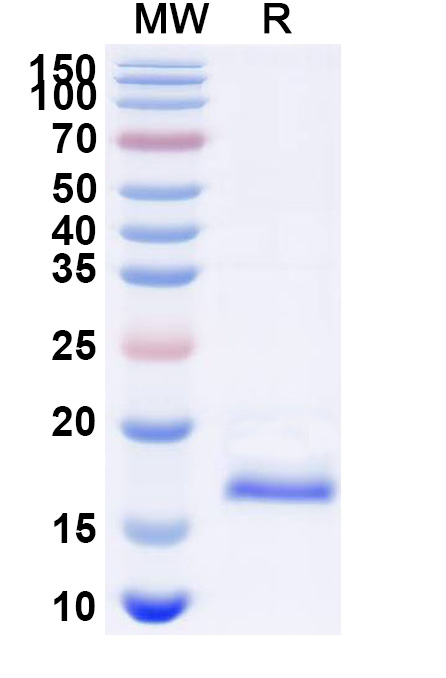 SDS-PAGE for Anti-Human AGTR1 VHH (SAA1005)