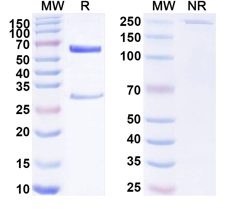 SDS-PAGE for Anti-Human AIMP1/EMAP-II Antibody (ABS1565)