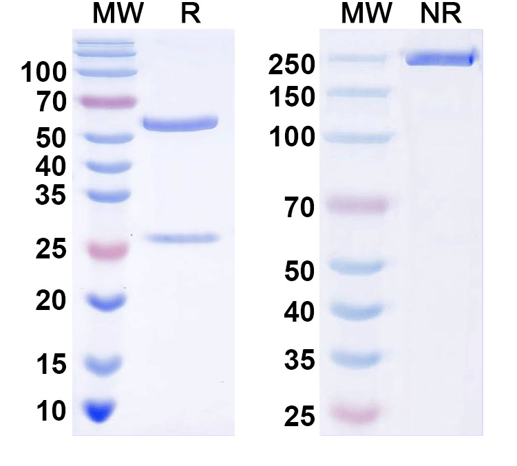 SDS-PAGE for Anti-Human Alpha-1-antitrypsin/AAT Z polymer specific Antibody (2C1)