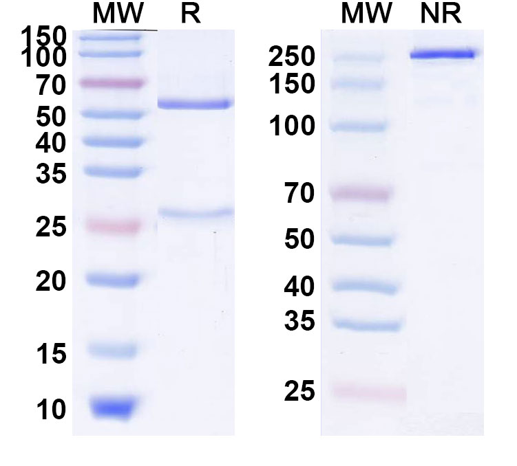 SDS-PAGE for Anti-Human Alpha-1-antitrypsin/SERPINA1 antibody (SAA2228)