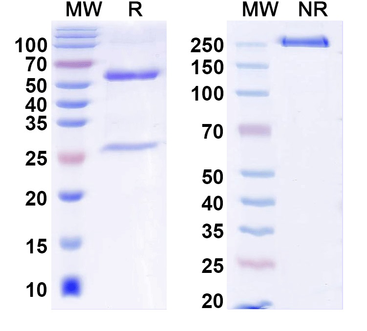 SDS-PAGE for Anti-Human Alpha-1-antitrypsin/SERPINA1 Antibody (SAA2548)