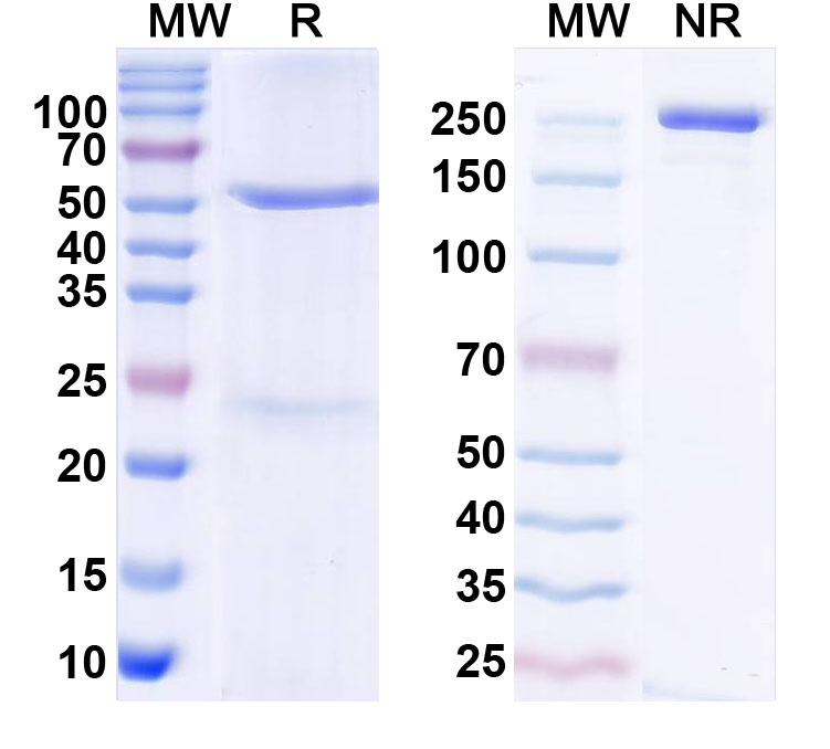 SDS-PAGE for Anti-Human Angiotensin-2 Antibody (SAA2578)