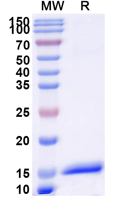 SDS-PAGE for Anti-Human ANGPT1 VHH (SAA1256)