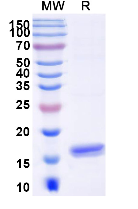 SDS-PAGE for Anti-Human ANGPT2/Ang2 VHH (SAA1255)