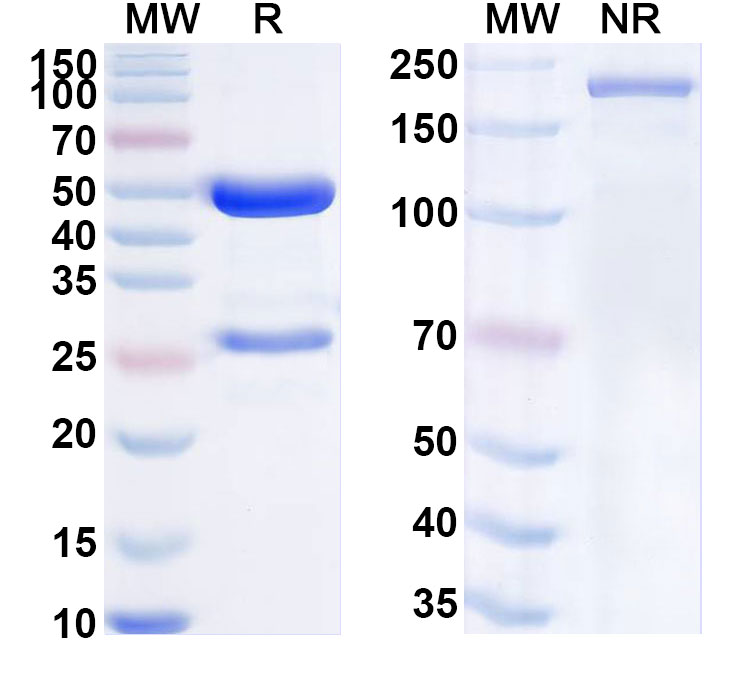 SDS-PAGE for Anti-Human ANTXR1/TEM8 Antibody (ABS0608)