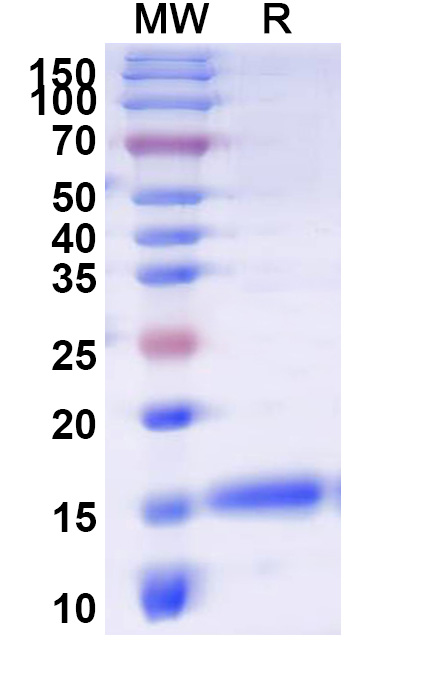 SDS-PAGE for Anti-Human APLNR VHH (SAA1115)