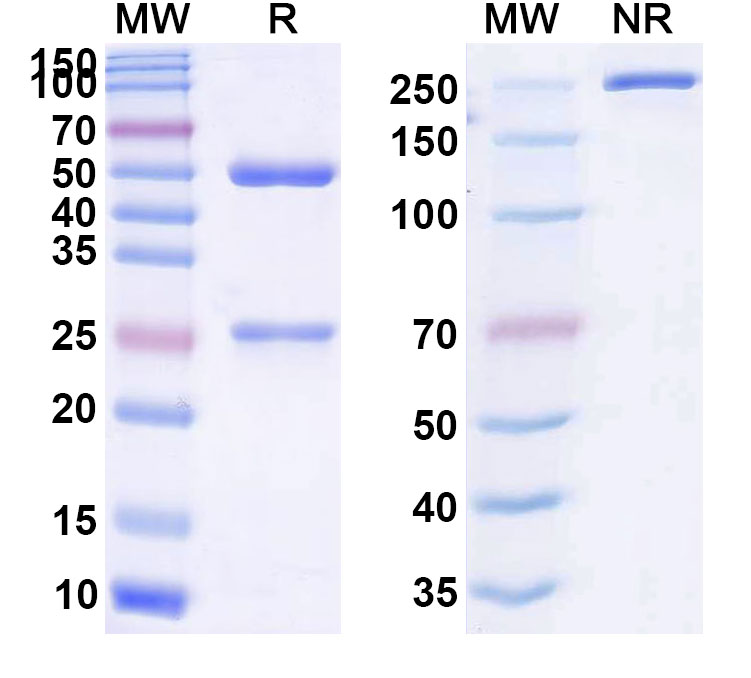 SDS-PAGE for Anti-Human ATAD2B IP Antibody (SAA0243)