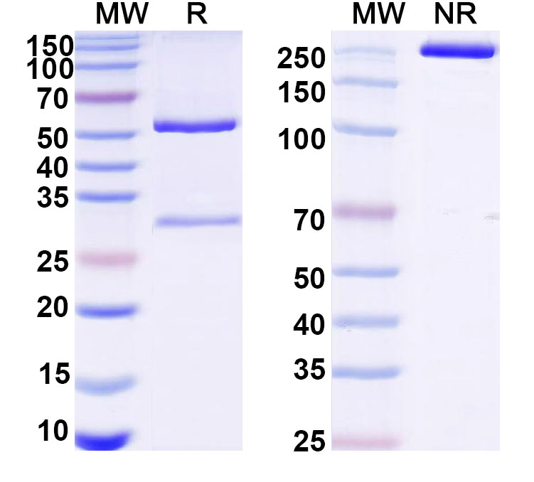SDS-PAGE for Anti-Human ATP5PB Monoclonal Antibody (1A480)
