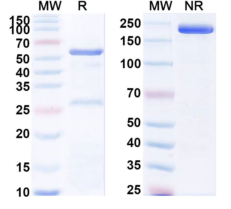 SDS-PAGE for Anti-Human ATP6AP2/Prorenin receptor Antibody (ABS2014)