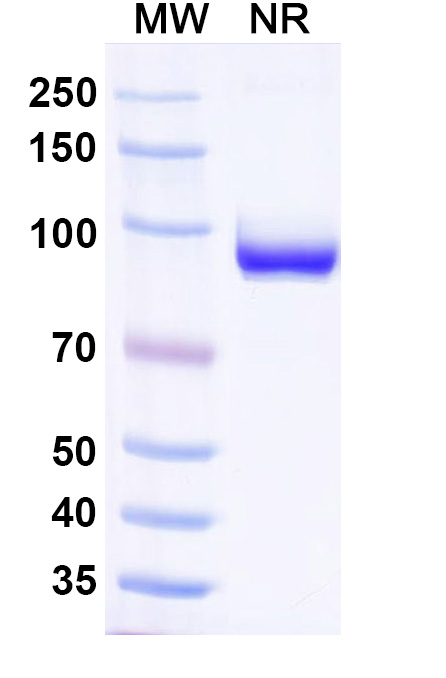 SDS-PAGE for Anti-Human B2M/Beta-2-microglobulin VHH (SAA2322)